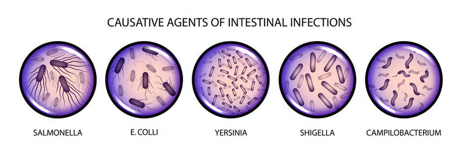 肠道感染的病原体