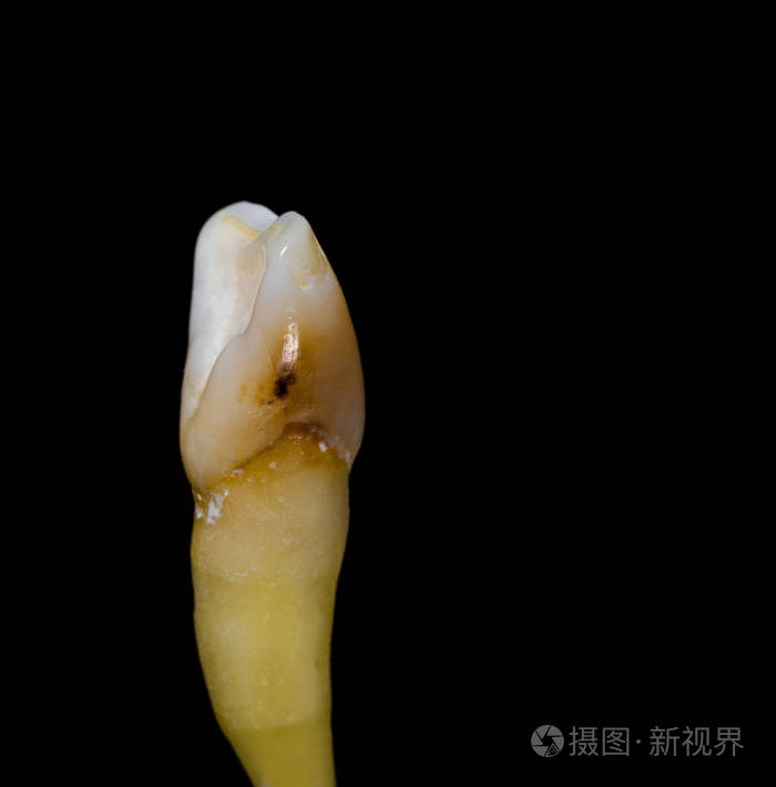 牙齿隔离在黑色