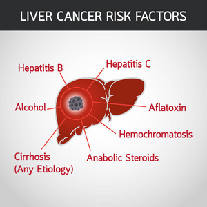 肝癌危险因素矢量徽标图标图示