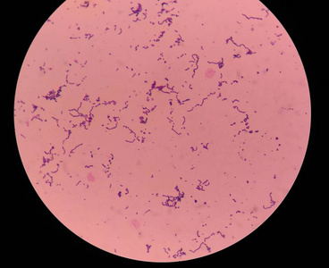 用显微镜发现细菌细胞图片