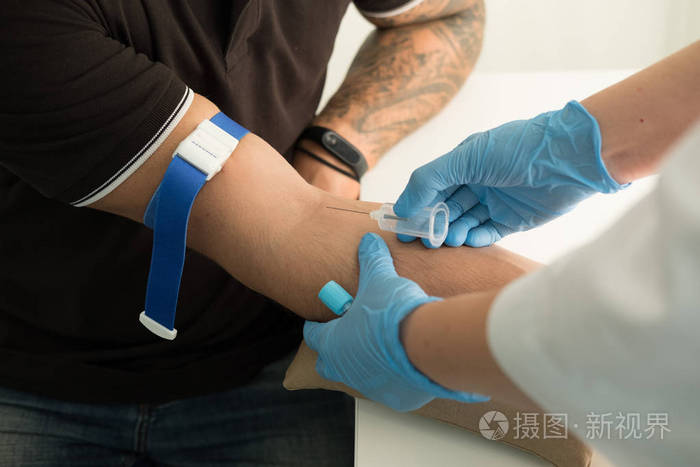 在手臂病人上抽针注射器抽取血样进行血液化验关闭