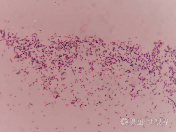 革兰氏染色试验显示细菌细胞