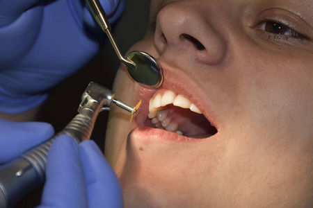 牙医检查病人牙齿的牙医椅子上在牙科诊所的明亮的灯光下