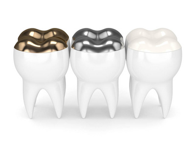 3d 不同类型补牙牙的牙齿呈现