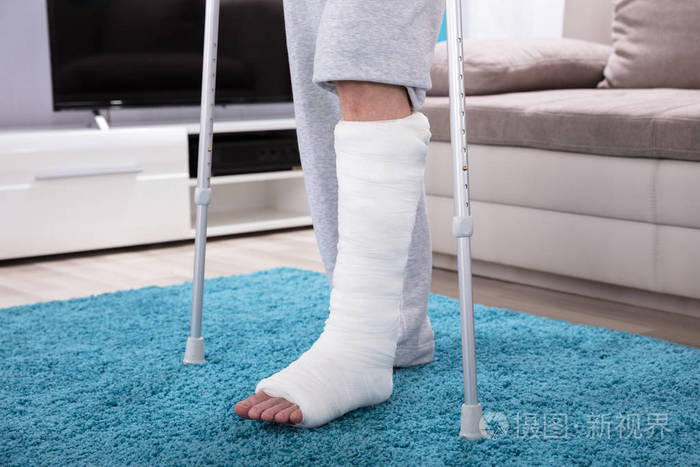 用拐杖走路的人, 腿断了, 走在蓝地毯上