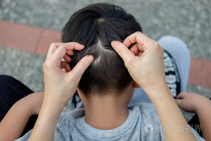 妈妈正在抓头发来找虱子