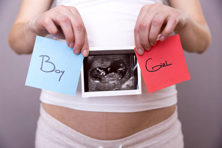 孕妇手持超声扫描及蓝红贴