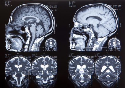 人类的大脑磁共振成像