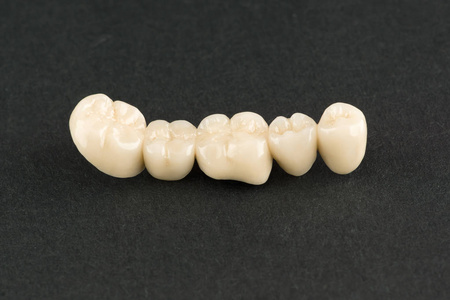 牙列修复用陶瓷人工牙科结构的研究