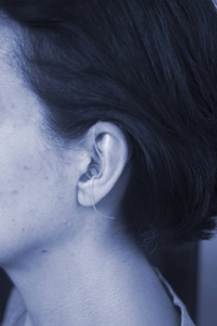 聋中年女士戴现代数字高科技助听器耳
