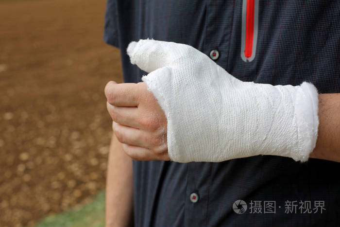 手的拇指和手腕完全贴在骨折后的骨骼
