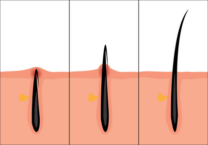 正常和嵌头发向量例证