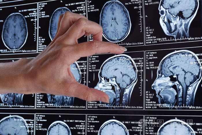 核磁共振仪价格_低频共振仪_自旋量子共振仪价格