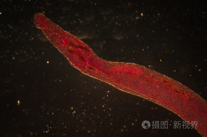 动物parasiteras血吸虫血吸虫