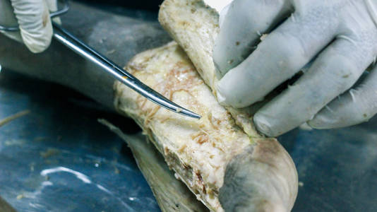 用手术刀剪和钳割皮瓣显示足背的解剖解剖血管神经的重要结构