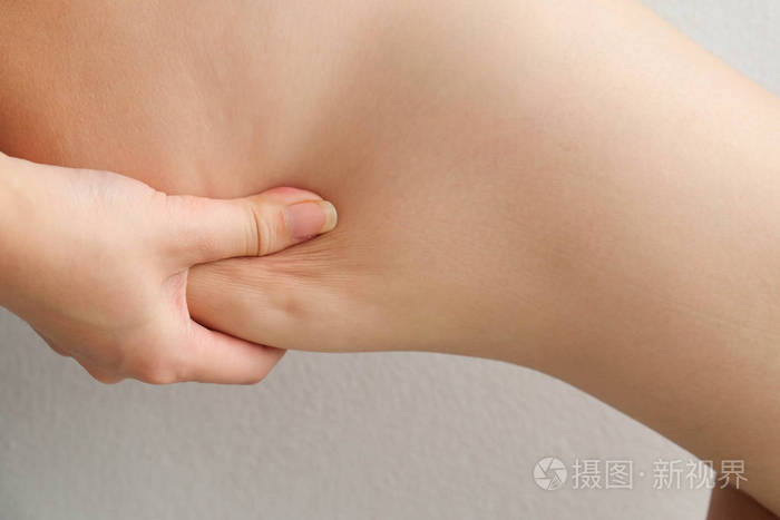 女性腿大腿与脂肪团.