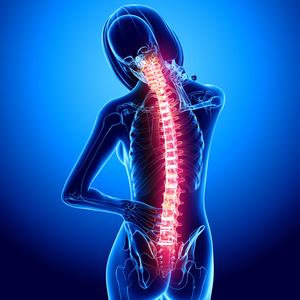女性脊柱疼痛图片