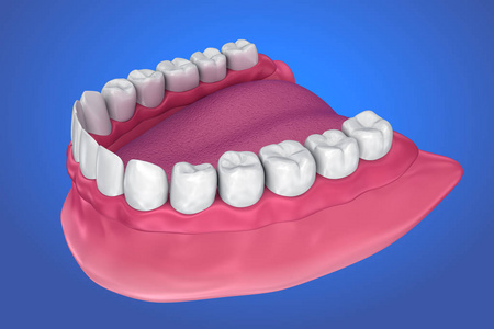 所有缺牙可拆卸全口义齿。3d 插图