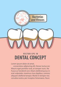布局细菌和与肮脏的牙例证 vecto