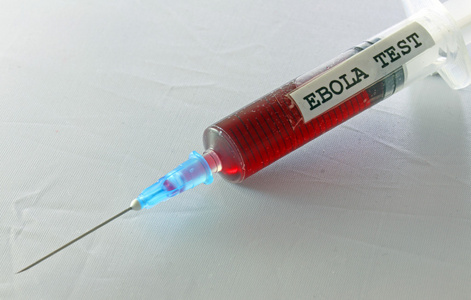 注射器与血液感染埃博拉