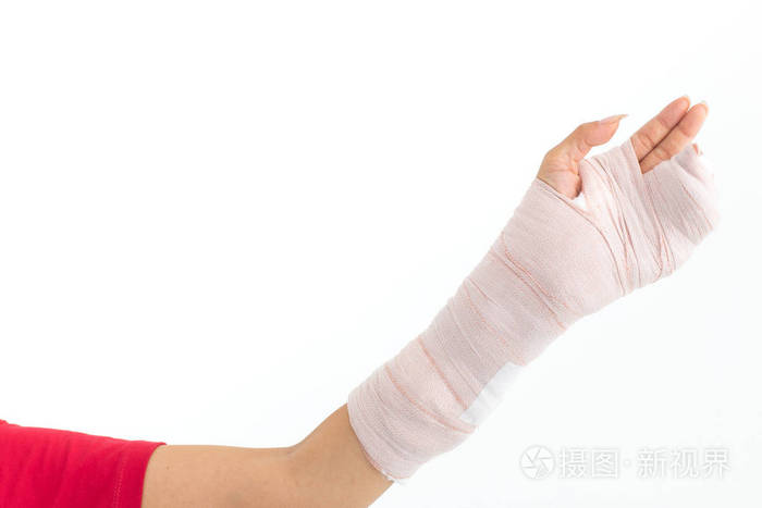 在白色背景下拍摄的石膏铸造工作室的妇女的手折断的手臂