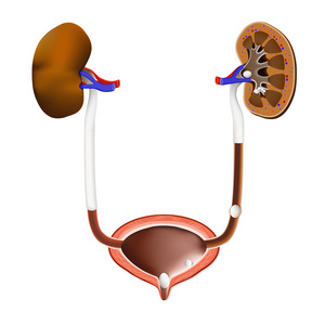 肾 膀胱 输尿管结石