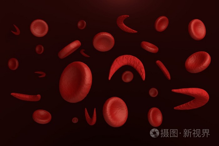 镰刀和正常红血细胞照片-正版商用图片0929hl-摄图新视界