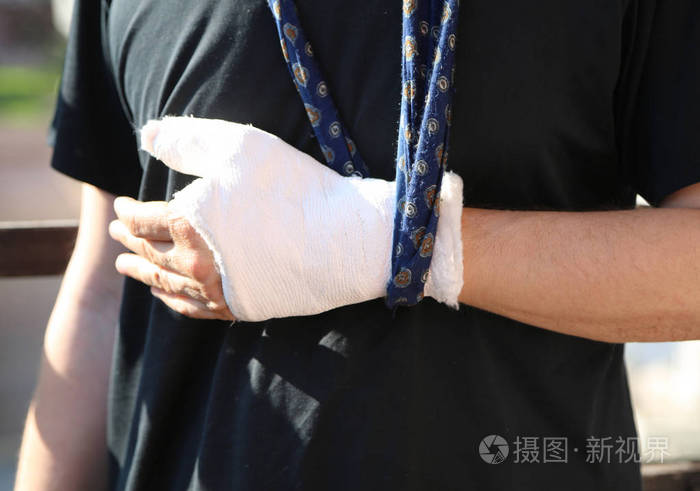 男子在事件后, 他的手臂在他的脖子, 他的手与白色石膏和黑色 t恤骨折