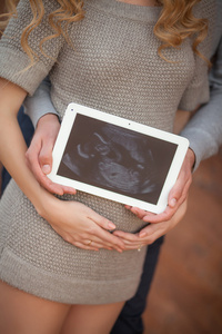 孕妇的丈夫在她肚子上抱着超声波扫描