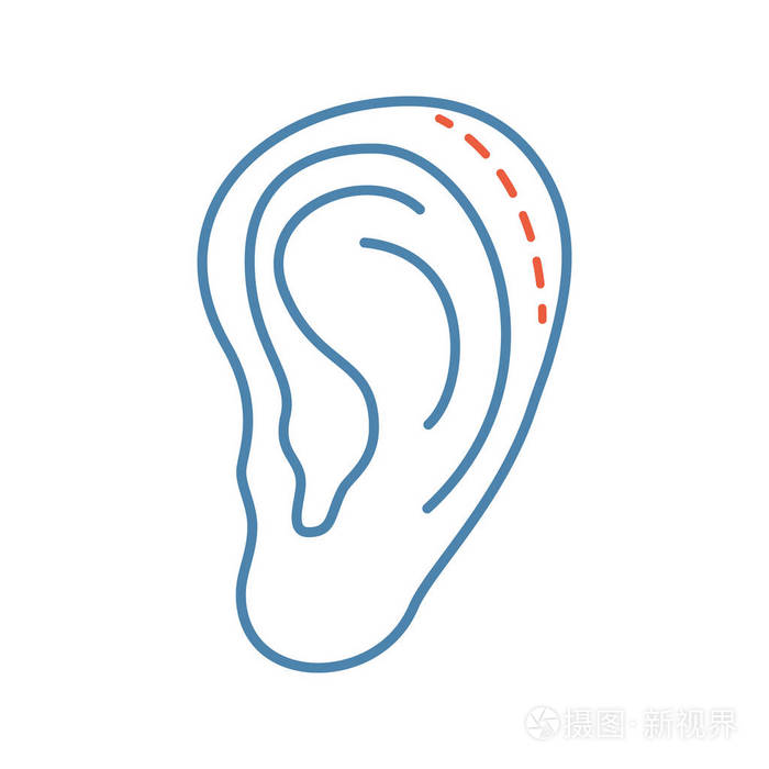 耳廓成形术.耳整形和重建.面部复兴.孤立向量例证