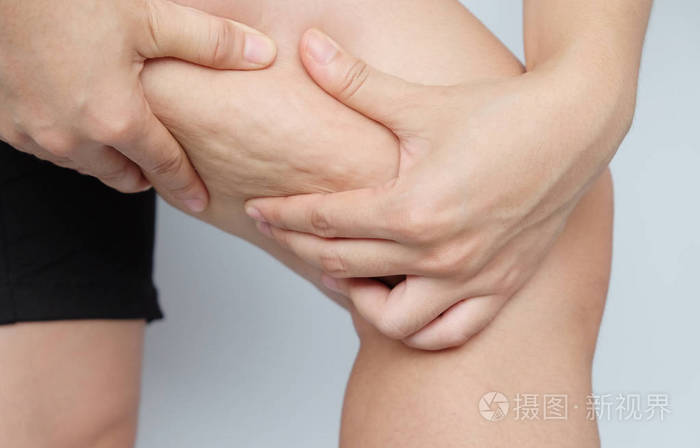 女性腿大腿与脂肪团.