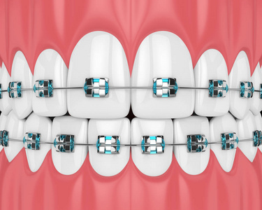 3d. 在白色背景下, 用牙齿和正畸大括号将颚体渲染