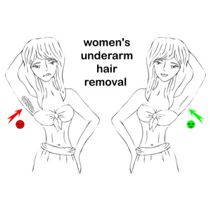 卡通女人做脱毛前后。妇女的腋下脱毛的概念。不需要的头发, 多余的头发