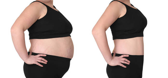在白色背景上减肥前后的女性身体。卫生保健和饮食概念