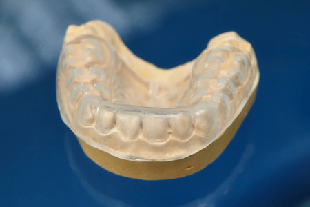 牙体修复牙模 粘土人类牙龈模型