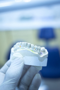 牙模牙医粘土牙齿陶瓷板铸造模型