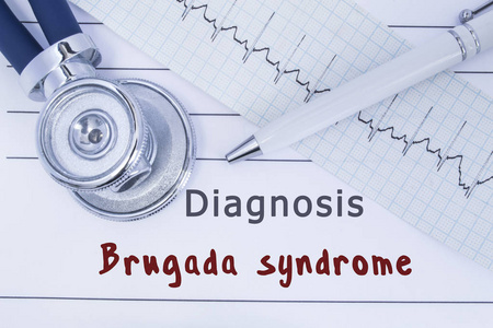 诊断 Brugada 综合征。听诊器或 phonendoscope 与心电图类型一起躺在医学史上标题诊断 Brugada 综合征