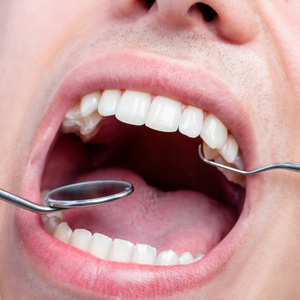 人类男性牙齿排列显示