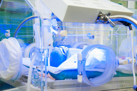 新生儿婴儿在紫外线照射下治疗早产儿黄疸