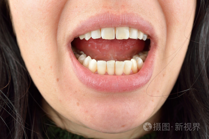 健康的牙齿的年轻女人的特写.牙科保健服务.hy