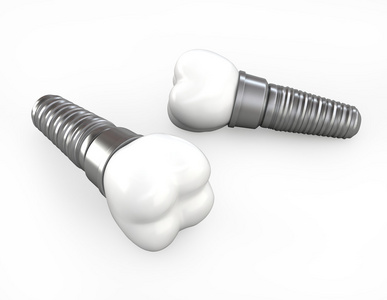 3d 插图的牙齿植入物白色背景