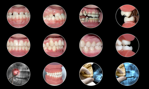牙科医疗信息图表元素口腔正畸学集合