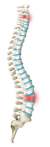 回来的脊椎痛图