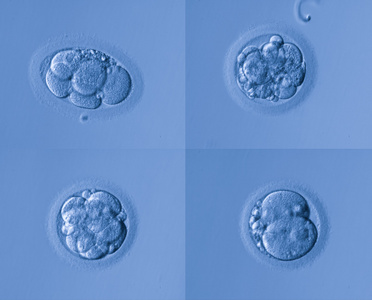 人工授精或 ivf