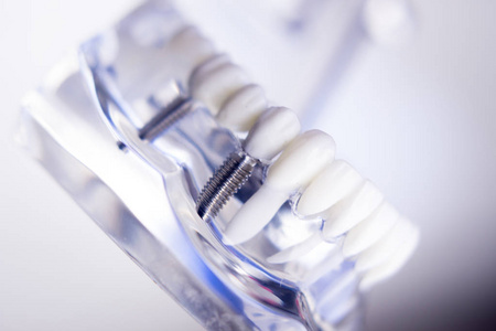 牙医牙科牙齿模型