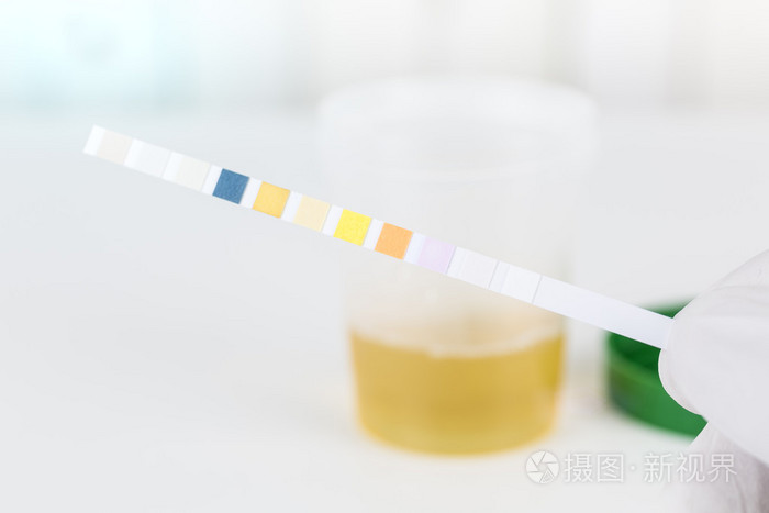 医疗尿液测试与尿试纸条,关闭