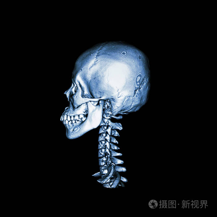 与3d 图像的正常人类的头颅骨和颈椎 ct 扫描.横向视图