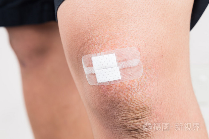 用石膏绷带包扎膝盖上的瘀伤