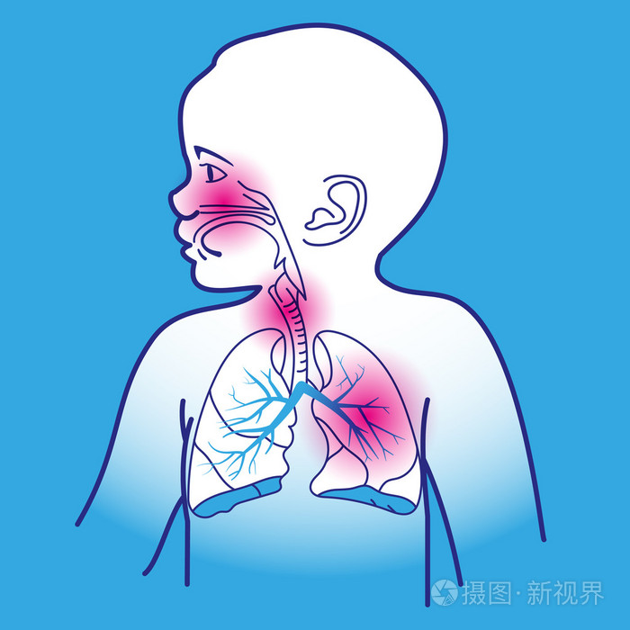 儿童呼吸道计划