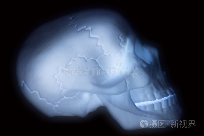 下载小样发票合同问题/举报颌骨x光照片面部x光x光,人头牙科全景x光片